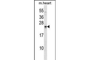 SOSTDC1 Antibody (C-term) (ABIN1536776 and ABIN2849017) western blot analysis in mouse heart tissue lysates (35 μg/lane). (SOSTDC1 抗体  (C-Term))