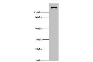 Western blot All lanes: EIF2AK4 antibody at 2 μg/mL + Mouse lung tissue Secondary Goat polyclonal to rabbit IgG at 1/10000 dilution Predicted band size: 187, 184, 70 kDa Observed band size: 187 kDa (GCN2 抗体  (AA 1-300))