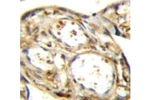 DLK antibody immunohistochemistry analysis in formalin fixed and paraffin embedded human placenta tissue. (MAP3K12 抗体)