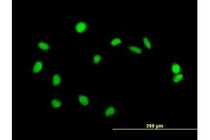 Immunofluorescence of purified MaxPab antibody to ZBED1 on HeLa cell. (ZBED1 抗体  (AA 1-694))