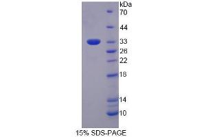 SDS-PAGE analysis of Human EIF3M Protein. (Eukaryotic Translation Initiation Factor 3, Subunit M (EIF3M) 蛋白)