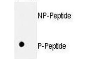 Dot blot analysis of p-Rb1 antibody. (Retinoblastoma Protein (Rb) 抗体  (pSer811))