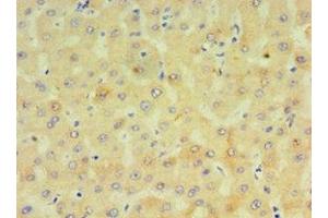 Immunohistochemistry of paraffin-embedded human liver tissue using ABIN7149272 at dilution of 1:100 (CYP4F12 抗体  (AA 265-524))