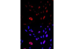 Immunofluorescence (IF) image for anti-HUS1 Checkpoint Homolog (S. Pombe) (HUS1) antibody (ABIN1876595) (HUS1 抗体)