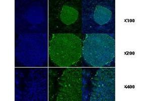 Immunofluorescenitrocellulosee staining of human ES cell colony with monoclonal anti-human TRA1 antibody (2H3)