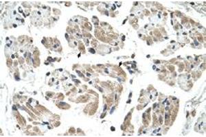 Immunohistochemical staining (Formalin-fixed paraffin-embedded sections) of human muscle with CHST1 polyclonal antibody  at 4-8 ug/mL working concentration. (CHST1 抗体  (N-Term))