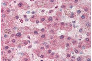 Human Liver (formalin-fixed, paraffin-embedded) stained with PC antibody ABIN337183 at 5 ug/ml followed by biotinylated anti-goat IgG secondary antibody ABIN481715, alkaline phosphatase-streptavidin and chromogen. (PC 抗体  (AA 886-899))