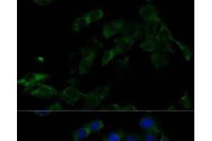 Immunofluorescence analysis of C6 cells using ATP6V0C Polyclonal Antibody at dilution of 1:100 (40x lens). (ATP6V0C 抗体)