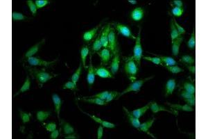 Immunofluorescence staining of Hela cells with ABIN7159933 at 1:100, counter-stained with DAPI. (LETM1 抗体  (AA 443-543))