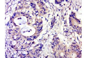 Paraformaldehyde-fixed, paraffin embedded human cervical carcinoma, Antigen retrieval by boiling in sodium citrate buffer (pH6. (NDEL1 抗体  (pSer242))