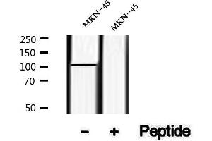 Western blot analysis of extracts of MKN-45 cells , using Phospho-Semaphorin 4B (Ser825) Antibody.
