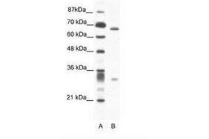 Image no. 1 for anti-Set1/Ash2 Histone Methyltransferase Complex Subunit ASH2 (ASH2L) (AA 54-103) antibody (ABIN202839) (ASH2L 抗体  (AA 54-103))