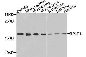 Western blot analysis of extracts of various cells, using RPLP1 antibody. (RPLP1 抗体)