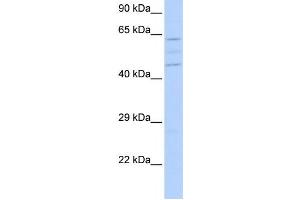Western Blotting (WB) image for anti-Vacuolar Protein Sorting 37 Homolog A (VPS37A) antibody (ABIN2459607) (VPS37A 抗体)
