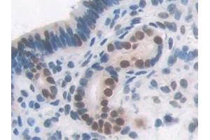 Immunohistochemistry (IHC) image for anti-Transaldolase 1 (TALDO1) (AA 35-285) antibody (ABIN7440293)