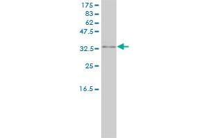 Western Blotting (WB) image for anti-Protein Kinase, Interferon-Inducible Double Stranded RNA Dependent Activator (PRKRA) (AA 1-313) antibody (ABIN563706)