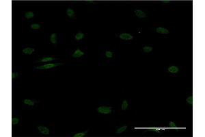 Immunofluorescence of monoclonal antibody to EGR1 on HeLa cell. (EGR1 抗体  (AA 211-320))