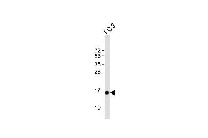 Anti-D Antibody (N-term) at 1:1000 dilution + PC-3 whole cell lysate Lysates/proteins at 20 μg per lane. (DAP 抗体  (N-Term))