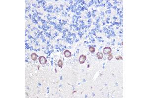 Immunohistochemistry of paraffin-embedded rat brain using PLC beta 3 (PLC beta 3 (PLCB3)) Rabbit pAb (ABIN6134972, ABIN6145749, ABIN6145750 and ABIN6214407) at dilution of 1:100 (40x lens). (PLCB3 抗体  (AA 1050-1150))