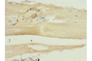 Immunohistochemistry of paraffin-embedded human skeletal muscle tissue using ABIN7169457 at dilution of 1:100 (SH2B1 抗体  (AA 360-520))