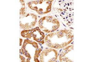 Immunohistochemical analysis of paraffin-embedded H. (CALB1 抗体  (AA 90-116))