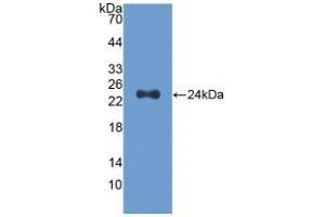 Detection of Recombinant Slit2, Human using Polyclonal Antibody to Slit Homolog 2 (Slit2) (SLIT2 抗体  (AA 1160-1333))