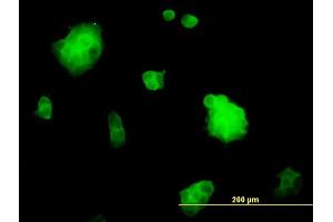 Immunofluorescence (IF) image for anti-Slingshot Homolog 3 (SSH3) (AA 293-391) antibody (ABIN565792)