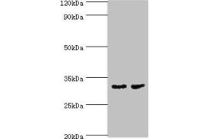 Western blot All lanes: CA8 antibody at 4 μg/mL Lane 1: Mouse skeletal muscle tissue Lane 2: Mouse liver tissue Secondary Goat polyclonal to rabbit IgG at 1/10000 dilution Predicted band size: 33 kDa Observed band size 33 kDa (CA8 抗体  (AA 1-290))