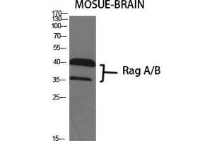 Western Blot (WB) analysis of specific cells using Rag A/B Polyclonal Antibody. (RagA/B (C-Term) 抗体)