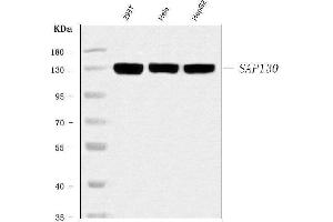 Western blot analysis of SAP130 using anti-SAP130 antibody (ABIN7601247).