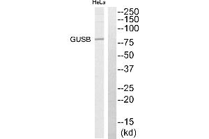 Western blot analysis of extracts from HeLa cells, using GUSB antibody. (Glucuronidase beta 抗体)
