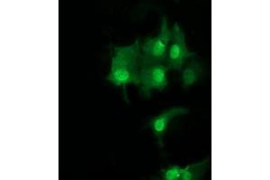 Image no. 3 for anti-Ubiquitin-Conjugating Enzyme E2S (UBE2S) antibody (ABIN1501643) (UBE2S 抗体)