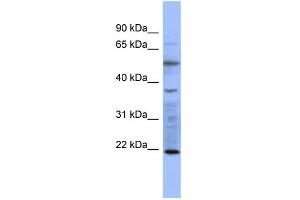 WB Suggested Anti-MYL3 Antibody Titration:  0. (MYL3/CMLC1 抗体  (N-Term))