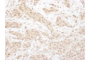 Immunohistochemistry (IHC) image for anti-Cyclin-Dependent Kinase 4 (CDK4) (AA 253-303) antibody (ABIN7455013) (CDK4 抗体  (AA 253-303))