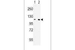 Western blot analysis of MTTP Antibody (C-term) (ABIN653011 and ABIN2842637) in Hela(lane 1), 293(lane 2) cell line lysates (35 μg/lane). (MTTP 抗体  (C-Term))
