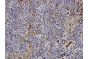 Immunoperoxidase of monoclonal antibody to FGR on formalin-fixed paraffin-embedded human lymph node. (Fgr 抗体  (AA 1-90))