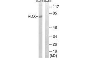 Western blot analysis of extracts from HuvEc cells, using RDX Antibody. (Radixin 抗体  (AA 142-191))