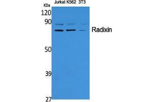 Western Blot (WB) analysis of specific cells using Radixin Polyclonal Antibody. (Radixin 抗体  (Internal Region))