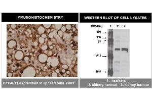 Immunohistochemistry (IHC) image for anti-Cytochrome P450, Family 4, Subfamily F, Polypeptide 11 (CYP4F11) (C-Term) antibody (ABIN264503) (CYP4F11 抗体  (C-Term))