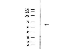 anti-Tubulin Folding Cofactor E (TBCE) (N-Term) antibody