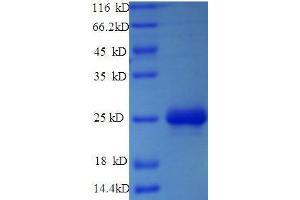 Chymase 1, Mast Cell (CMA1) (AA 22-249), (full length) protein (His tag) (CMA1 Protein (AA 22-249, full length) (His tag))