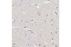 Immunohistochemical staining of human lateral ventricle with ASPHD2 polyclonal antibody  shows cytoplasmic positivity in neuronal cells. (ASPHD2 抗体)