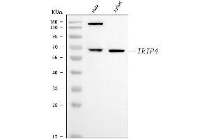 Western blot analysis of ASC1/TRIP4 using anti-ASC1/TRIP4 antibody (ABIN7600159).