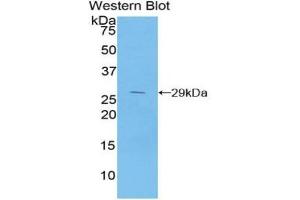 Detection of Recombinant IkBb, Mouse using Polyclonal Antibody to Inhibitory Subunit Of NF Kappa B Beta (IkBb) (Inhibitory Subunit of NF kappa B beta (AA 117-345) 抗体)