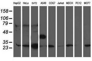 Image no. 2 for anti-phosphoglycerate Mutase 2 (Muscle) (PGAM2) antibody (ABIN1500170) (PGAM2 抗体)