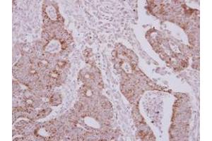 Image no. 1 for anti-Asparaginyl-tRNA Synthetase 2, Mitochondrial (Putative) (NARS2) (AA 7-276) antibody (ABIN1499648) (NARS2 抗体  (AA 7-276))
