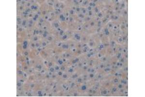 IHC-P analysis of Mouse Liver Tissue, with DAB staining. (PD-L1 抗体  (AA 48-290))