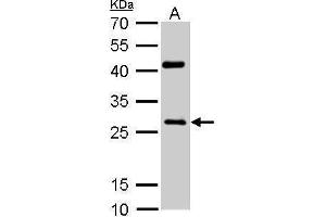 WB Image NQO1 antibody [C2C3], C-term detects NQO1 protein by Western blot analysis. (NQO1 抗体  (C-Term))
