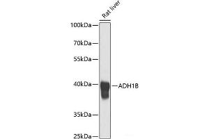 Western blot analysis of extracts of Rat liver using ADH1B Polyclonal Antibody at dilution of 1:1000.