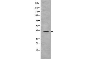 Western blot analysis of ROAA expression in HEK293 cells ,The lane on the left is treated with the antigen-specific peptide. (HNRNPAB 抗体  (N-Term))